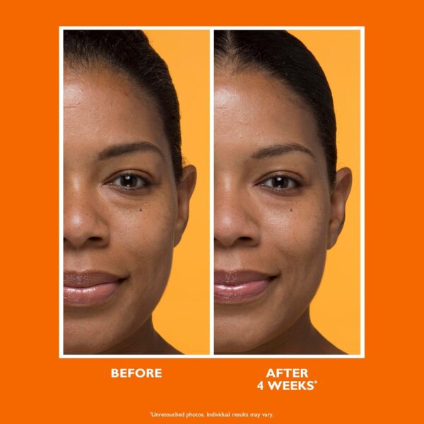 Peter Thomas Roth | Potent-C Brightening Vitamin C Moisturizer, For Dullness, Uneven Skin Tone, Dark Spots and Wrinkles, Antioxidant Moisturizer - Image 3